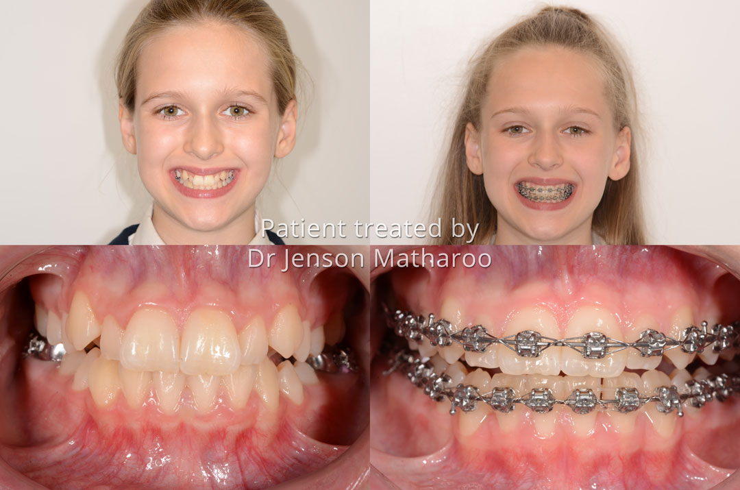 Jessica testimonial for Dumfries Orthodontics