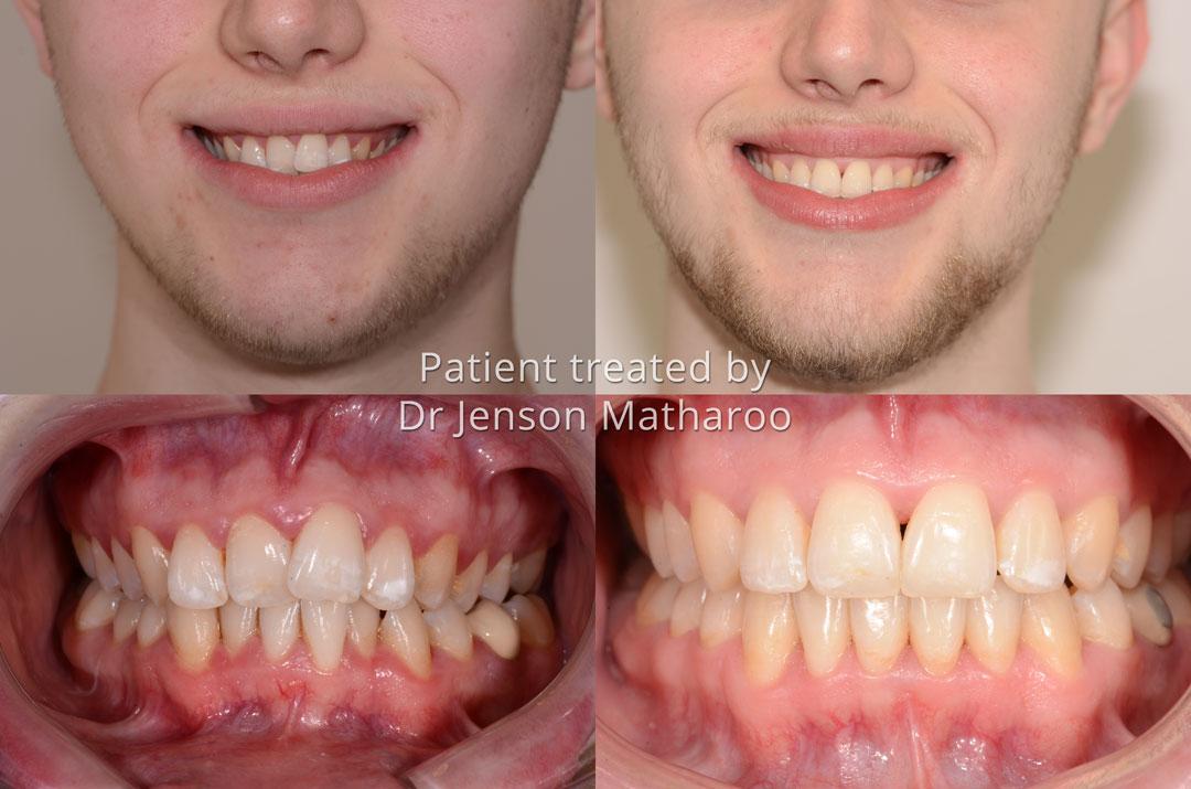 Luke testimonial for Dumfries Orthodontics